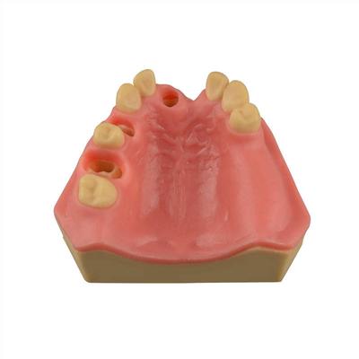 Dental Implant Training Practice Maxillary Model Sinus Basic Implant Training Model Practice Soft Gums Dental Training Tooth